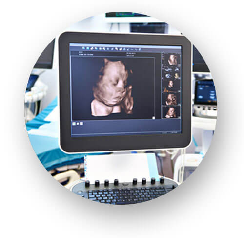 3D/4D-Ultraschall in der PRÄNATALPRAXIS LEIPZIG Dr. med. Simone Glasow